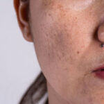 manchas-piel-serum-intense-kaare-skin-cosmetics-03